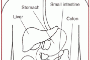 What Is Celiac Disease